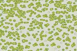 Ковролин Forbo Flotex Sottsass Bacteria 990203 фото  | FLOORDEALER
