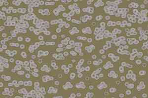 Ковролин Forbo Flotex Sottsass Bacteria 990401 фото  | FLOORDEALER
