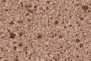 Линолеум Grabo Terrana Top Extra 4115-272 фото  | FLOORDEALER
