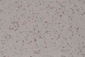Линолеум DLV Flooring Perfect Safety 5605 фото  | FLOORDEALER