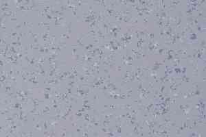 Линолеум DLV Flooring Perfect Safety 5610 фото  | FLOORDEALER