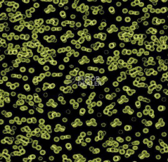 Ковролин Forbo Flotex Sottsass Bacteria 990103 фото 1 | FLOORDEALER